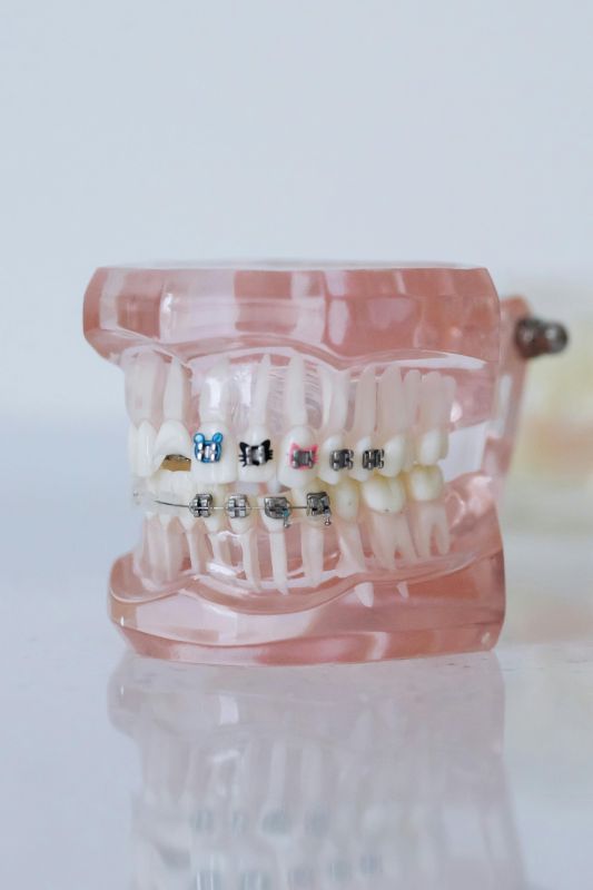 Why Orthodontic Treatment Matters